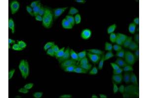 Immunofluorescence staining of PC-3 cells with ABIN7167258 at 1:133, counter-stained with DAPI. (RAB24 Antikörper  (AA 122-197))