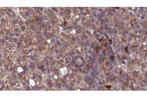 Immunohistochemistry (IHC) image for anti-Integrin alpha-L (ITGAL) (N-Term) antibody (ABIN6262686)