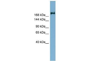 WB Suggested Anti-TMEM2 Antibody Titration:  0. (TMEM2 Antikörper  (Middle Region))