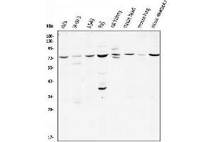 Western blot analysis of CD239/BCAM using anti-CD239/BCAM antibody (ABIN7602976).