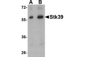 Western Blotting (WB) image for anti-serine threonine Kinase 39 (STK39) (Middle Region) antibody (ABIN1031111)