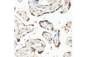 Immunohistochemistry of paraffin-embedded human placenta using KLF5 antibody (ABIN3023447, ABIN3023448, ABIN3023449 and ABIN6219969) at dilution of 1:100 (40x lens).