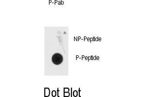 Image no. 1 for anti-Methyl CpG Binding Protein 2 (MECP2) (pSer80) antibody (ABIN358521) (MECP2 Antikörper  (pSer80))