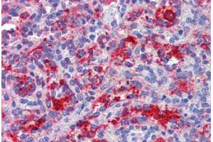 Spleen, Human: Formalin-Fixed, Paraffin-Embedded (FFPE) (DDX58 Antikörper)