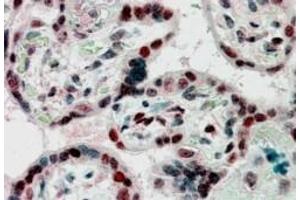 Immunohistochemistry (IHC) image for anti-Chromobox Homolog 1 (CBX1) antibody (ABIN5890958) (CBX1 Antikörper)