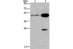 Western blot analysis of 231 and Hela cell, using CD160 Polyclonal Antibody at dilution of 1:300 (CD160 Antikörper)