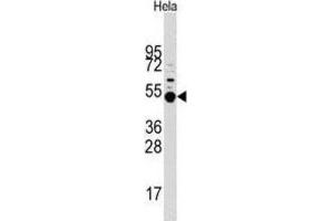 Western Blotting (WB) image for anti-Mitogen-Activated Protein Kinase-Activated Protein Kinase 5 (MAPKAPK5) antibody (ABIN3003051)