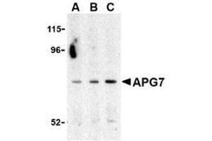 Western blot analysis of ATG7 in Caco-2 cell lysate with ATG7 Antibody at (A) 0. (ATG7 Antikörper  (C-Term))