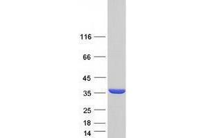 Western Blotting (WB) image for Tropomyosin 3 (TPM3) (Transcript Variant 4) protein (Myc-DYKDDDDK Tag) (ABIN2734393)