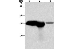 Western Blot analysis of Mouse brain and kidney tissue, Human fetal brain tissue using CALB1 Polyclonal Antibody at dilution of 1:750 (CALB1 Antikörper)