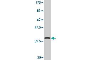 Western Blot detection against Immunogen (36. (CSTF1 Antikörper  (AA 332-431))