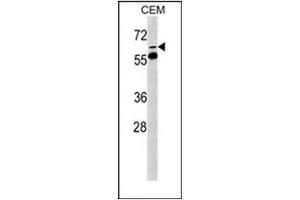 Image no. 2 for anti-FK506 Binding Protein 10, 65 KDa (FKBP10) (AA 65-94), (N-Term) antibody (ABIN453008) (FKBP10 Antikörper  (N-Term))