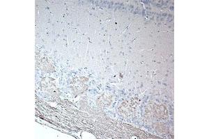 IHC on rat olfactory using Rabbit antibody to rat & mouse OMP (Olfactory Marker Protein): IgG  at a concentration of 20 µg/ml in paraffin embeded section. (OMP Antikörper)
