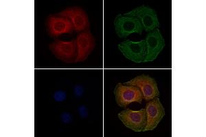 ABIN6262067 and ABIN6279097 staining Hela cells by IF/ICC. (GPT2 Antikörper  (Internal Region))