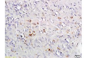 Formalin-fixed and paraffin embedded rat exfoliated cells tissue labeled with Anti-CCR4 Polyclonal Antibody, Unconjugated (ABIN738666) at 1:200 followed by conjugation to the secondary antibody and DAB staining (CCR4 Antikörper  (AA 201-300))