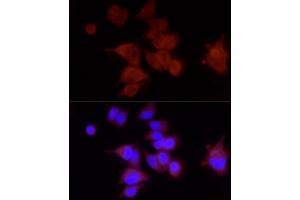 Immunofluorescence (IF) image for anti-Piezo-Type Mechanosensitive Ion Channel Component 1 (PIEZO1) (AA 2230-2420) antibody (ABIN6145612)