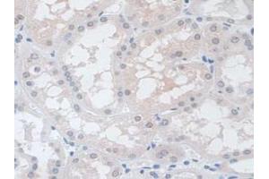 IHC-P analysis of Human Kidney Tissue, with DAB staining. (VCP Antikörper  (AA 125-371))