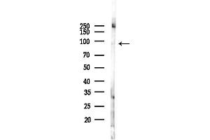 anti-Phospholipase A2, Group IVF (C-Term) antibody