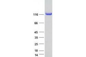 Validation with Western Blot (COL6 Protein (Myc-DYKDDDDK Tag))