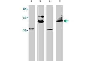 Western blot analysis using VSX2 polyclonal antibody at 1 ug/mL on rat liver (lane 1), retina tissue lysate (lane 2), mouse liver (lane 3) and retina (lane 4) tissue lysate. (VSX2 Antikörper  (AA 264-361))