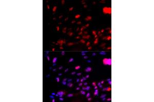 Immunofluorescence (IF) image for anti-Checkpoint Kinase 1 (CHEK1) (pSer317) antibody (ABIN1870071) (CHEK1 Antikörper  (pSer317))