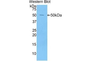 Western blot analysis of the recombinant protein. (Peroxiredoxin 1 Antikörper  (AA 1-199))