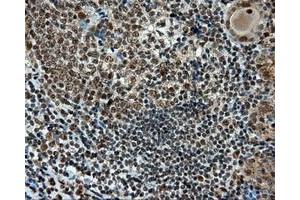 Immunohistochemical staining of paraffin-embedded Kidney tissue using anti-RC211175 mouse monoclonal antibody. (TUBA8 Antikörper)