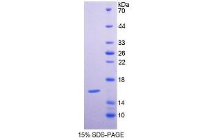 SDS-PAGE (SDS) image for Grancalcin, EF-Hand Calcium Binding Protein (GCA) (AA 1-139) protein (His tag) (ABIN6238650) (Grancalcin Protein (AA 1-139) (His tag))