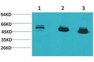 Western Blotting (WB) image for anti-Mitochondrial Calcium Uptake 1 (MICU1) antibody (ABIN3179096) (MICU1 Antikörper)