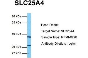 Host: Rabbit Target Name: SLC25A4 Sample Tissue: Human RPMI-8226 Antibody Dilution: 1. (SLC25A4 Antikörper  (N-Term))