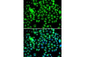 Immunofluorescence (IF) image for anti-Heat Shock 22kDa Protein 8 (HSPB8) (AA 1-196) antibody (ABIN3016167) (HSPB8 Antikörper  (AA 1-196))