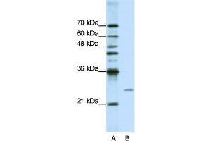 WB Suggested Anti-POP4 Antibody Titration:  1. (RPP29 Antikörper  (C-Term))