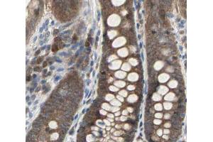 Immunohistochemistry (IHC) image for anti-Caspase 3 (CASP3) (Internal Region) antibody (ABIN6260481)