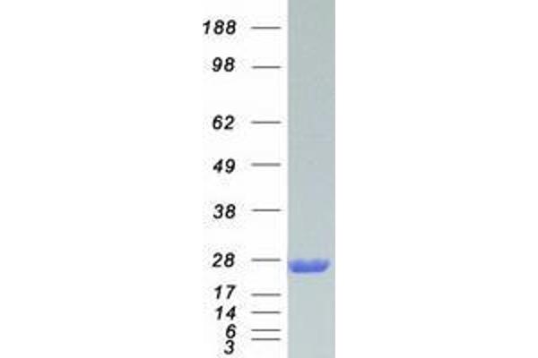 TAGLN2 Protein (Myc-DYKDDDDK Tag)