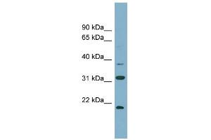 WB Suggested Anti-N6AMT1 Antibody Titration:  0. (N6AMT1 Antikörper  (N-Term))