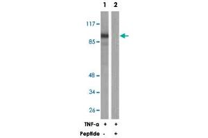 Western blot analysis of extracts from HeLa cells, treated with TNF-a (20 ng/mL, 30 mins), using PLA2G4A polyclonal antibody . (PLA2G4A Antikörper)