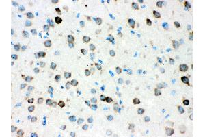 Anti- ATX2 Picoband antibody, IHC(P) IHC(P): Mouse Brain Tissue (Ataxin 2 Antikörper  (C-Term))