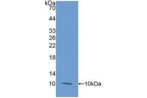 Detection of Recombinant S100A12, Human using Monoclonal Antibody to S100 Calcium Binding Protein A12 (S100A12) (S100A12 Antikörper  (AA 1-92))