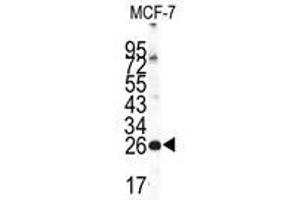 Image no. 1 for anti-Neuronal Calcium Sensor 1 (NCS1) (Center) antibody (ABIN357105) (NCS1 Antikörper  (Center))
