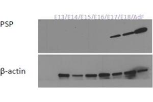 Western Blotting (WB) image for anti-Syntaxin Binding Protein 3 (STXBP3) (AA 146-160), (Internal Region) antibody (ABIN1108779) (STXBP3 Antikörper  (Internal Region))