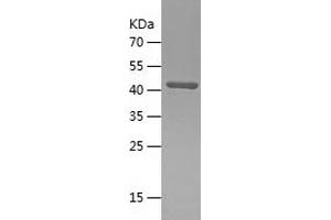 Western Blotting (WB) image for ClpP Caseinolytic Peptidase, ATP-Dependent, Proteolytic Subunit Homolog (E. Coli) (CLPP) (AA 66-277) protein (His-IF2DI Tag) (ABIN7122409) (CLPP Protein (AA 66-277) (His-IF2DI Tag))