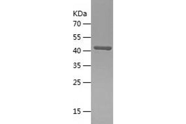 CLPP Protein (AA 66-277) (His-IF2DI Tag)
