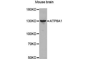 Western Blotting (WB) image for anti-ATPase, Class I, Type 8A, Member 1 (ATP8A1) antibody (ABIN1871182)