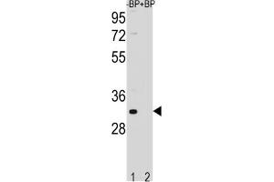 Western Blotting (WB) image for anti-Family with Sequence Similarity 26, Member F (FAM26F) antibody (ABIN3004478) (FAM26F Antikörper)