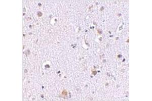 Immunohistochemistry of NUP160 in human brain tissue with NUP160 antibody at 2. (NUP160 Antikörper  (C-Term))