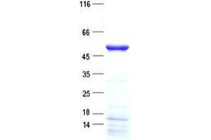 Western Blotting (WB) image for Trafficking Protein Particle Complex 13 (TRAPPC13) protein (His tag) (ABIN5505601)