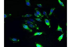 Immunofluorescence (IF) image for anti-IlvB (Bacterial Acetolactate Synthase)-Like (ILVBL) (AA 45-344) antibody (ABIN7142940)