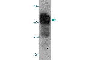 Western blot analysis of DYRK2 in 293 cell lysate with DYRK2 polyclonal antibody  at 1 ug/mL (lane 1) and 2 ug/mL (lane 2). (DYRK2 Antikörper  (C-Term))