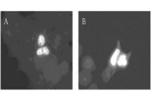 Image no. 1 for anti-Dual-Specificity tyrosine-(Y)-phosphorylation Regulated Kinase 1A (DYRK1A) (AA 486-763) antibody (ABIN297140) (DYRK1A Antikörper  (AA 486-763))