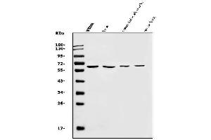 Western blot analysis of SLC22A3 using anti-SLC22A3 antibody (ABIN7603188).